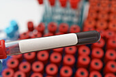 Test tube with a blood sample