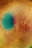 Biological tissue infected with pathogenic microorganisms