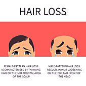 Hair loss in men and women, conceptual illustration