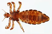 Body louse, LM