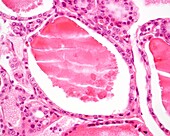 Human thyroid gland follicles, light micrograph