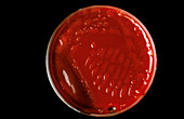 Petri dish culture of Klebsiella aerogenes