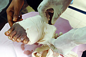 Bandaging a foot