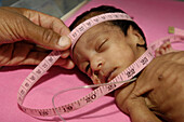 Neonatal nurse measuring the head of a premature baby