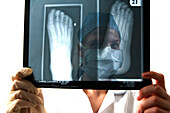 Surgeon examining X-ray