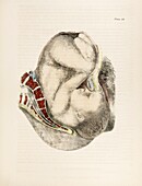 Childbirth, 19th century illustration