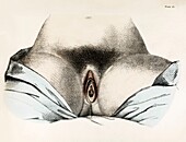 Female genitals, 19th century illustration