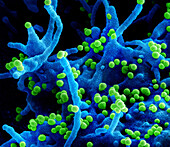 Lassa virus budding, SEM