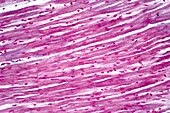 Cardiac muscle, light micrograph