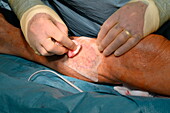 Surgeon applying skin graft to a patient's leg
