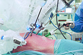 Robot-assisted heart surgery