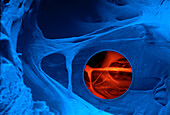 Interior of human heart, SEM and endoscopy