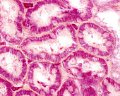 Mitochondria in kidney convoluted tubules, light micrograph