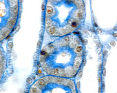 Kidney stained with Malloryâ??s trichrome, light micrograph