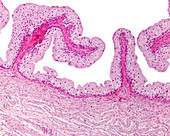 Urinary bladder, light micrograph