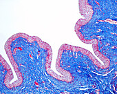 Urinary bladder epithelium, light micrograph