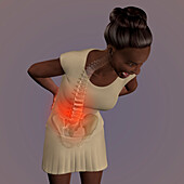 Woman with lower back pain, illustration