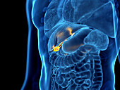Gallbladder cancer, illustration
