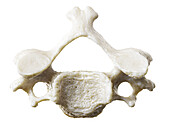 Cervical vertebrae, illustration