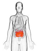 Elderly man's small intestine, illustration