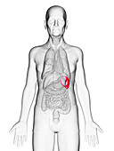 Elderly man's spleen, illustration