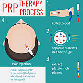 PRP hair treatment, illustration