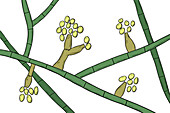 Madurella fungi, illustration