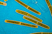 Pleurotaenium ehrenbergii algae, light micrograph