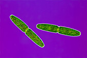 Pleurotaenium truncatum algae, light micrograph