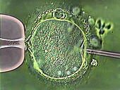 In vitro fertilisation, light micrograph