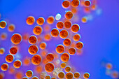Haematococcus sp., algae, light micrograph
