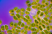 Staurastrum muricatum algae, light micrograph