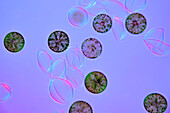 Eremosphaera viridis algae, light micrograph