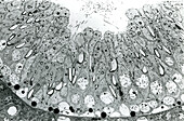 Spermatogenesis, light micrograph