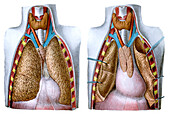 Thorax of a child, illustration