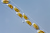 Encyonema freshwater diatoms, light micrograph