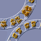 Eucampia marine diatoms, light micrograph