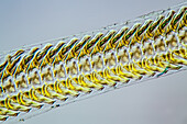 Radula of common periwinkle, light micrograph