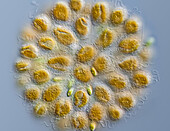 Synura uvella heterokont alga colony, light micrograph