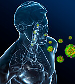 Viral respiratory infection, illustration