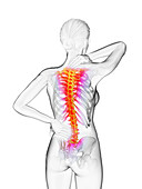 Woman having a backache, illustration
