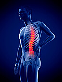 Man's painful back, illustration
