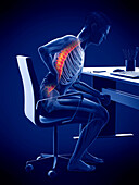 Man with backache due to sitting, illustration