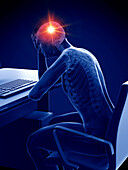 Man with a headache, illustration