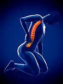 Man with acute back pain, illustration
