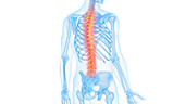 Painful back, illustration