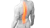 Painful back, illustration