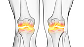 Painful knee joints, illustration