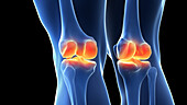 Painful knee joints, illustration