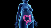 Obese woman's colon, illustration